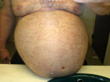 Bigbelly - Big Belly Chubs Beards Ballbelly