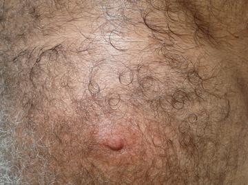 Image thumbnail of Gay chubs