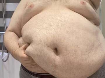 Image thumbnail of Gay chubs